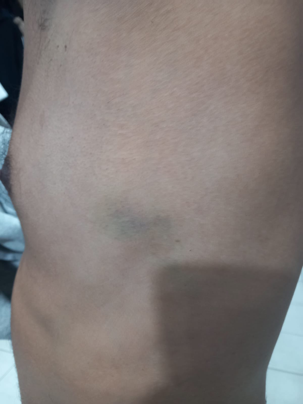 558469391 1206277708208820 7178572380849220459 n